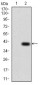 TFAP2A Antibody
